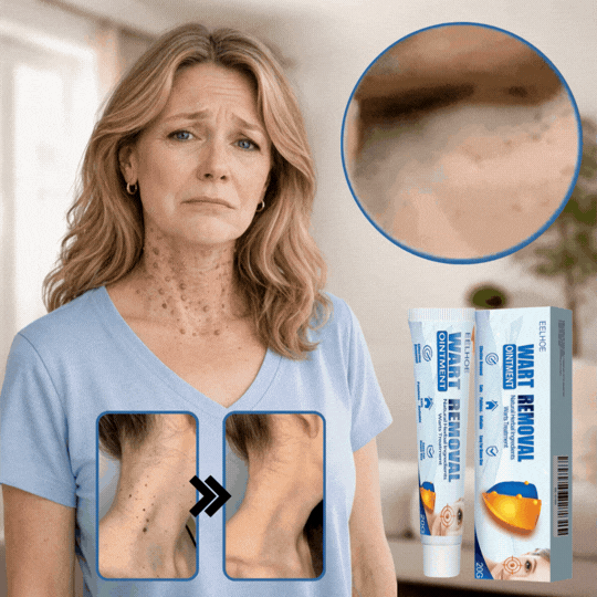 WartRemoval Creme | Fjerner 95 % af vorterne inden for 24 timer
