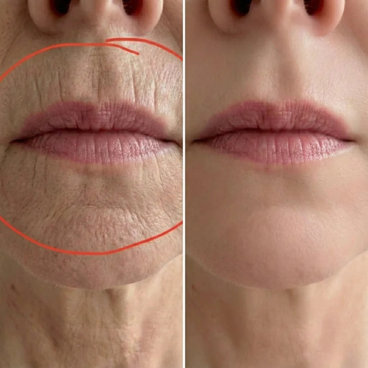 Til sygeplejersken, der kaldte dette for "Botox i en stick" — du havde ret