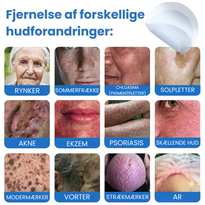 Ximonth 2-i-1 mikronål- og hydrokolloidplaster | Fjerner hævede modermærker, akne, flade vorter og hududvækster | Forbedrer rynker, ar og hudfejl | Usynlige stjerneformede plaster til ansigt og krop