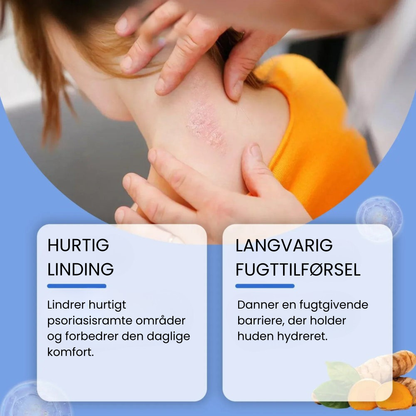 Bee Venom Psoriasis Spray | Lindrer hurtigt kløende hud
