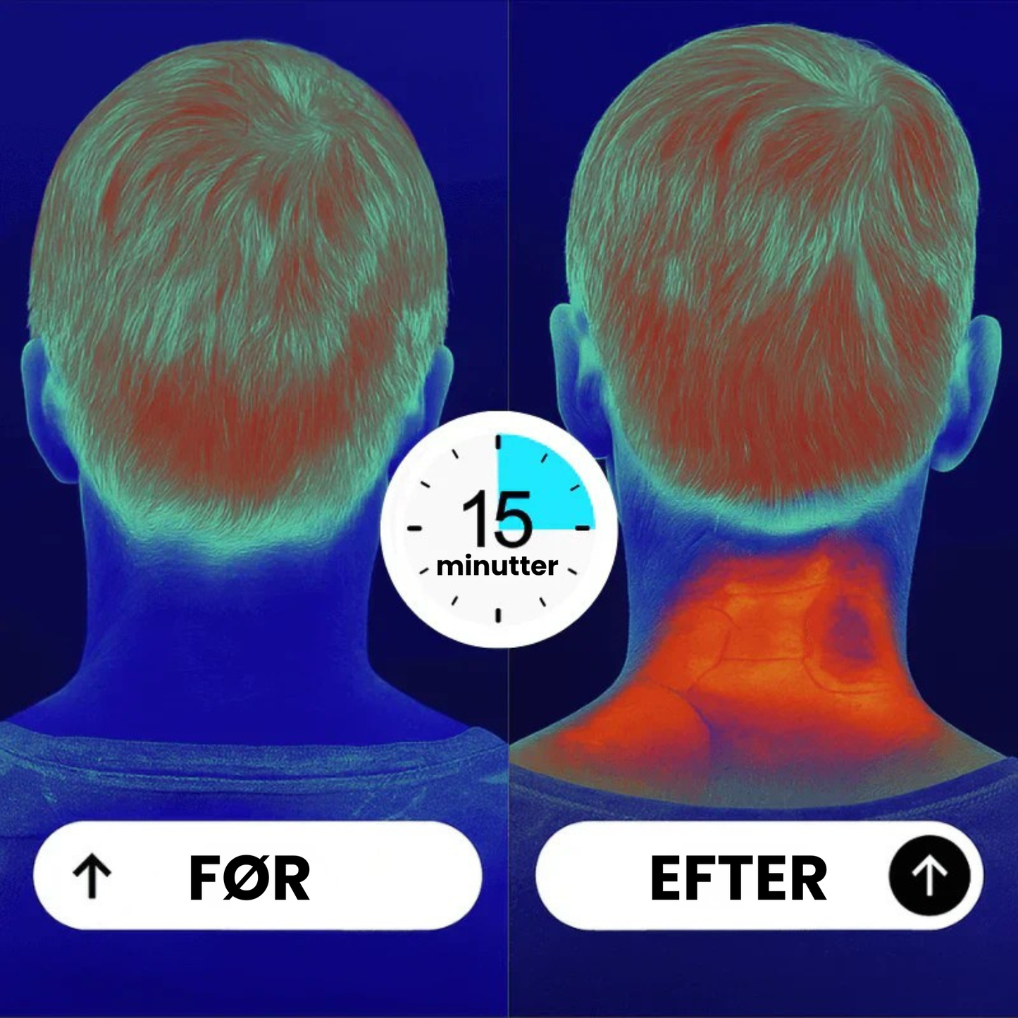 NakkeLind nakkemassager | Lindring af nakkespændinger derhjemme