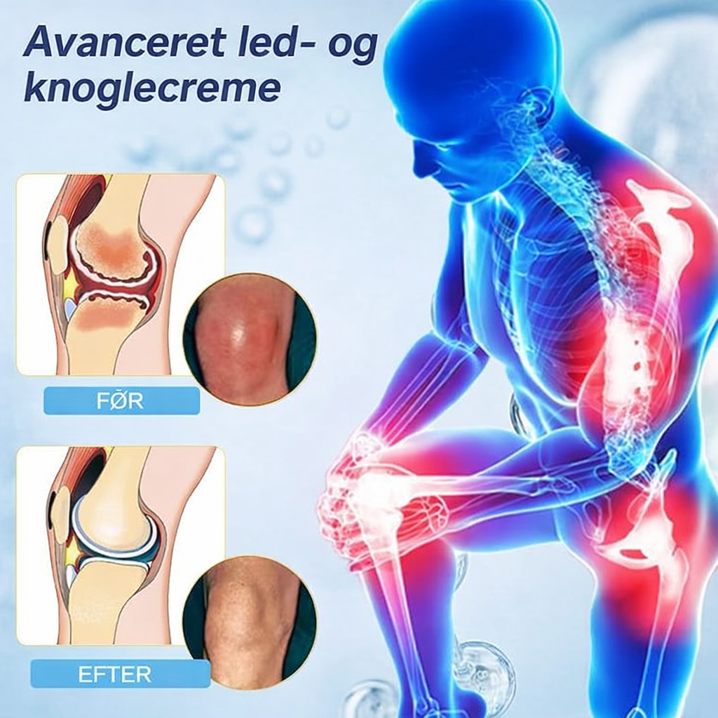 Laniska Joint Cream | Lindrer ledbesvær på bare 48 timer!